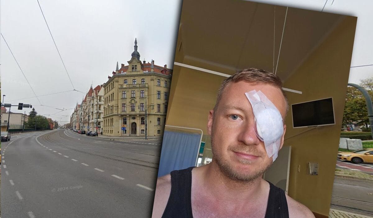 Toruńlu bir gazeteci havalı tüfekle gözünden vuruldu. Benzer bir olay daha. 1 Toru daki gazeteci 22 tufegiyle gozune ates edildi bir diger benzer olay 5209