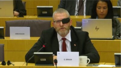 Gizemli bir goz bandi olan braun ne oldugunu acikladi bu ayinin gozu yerinden cikmis 9599