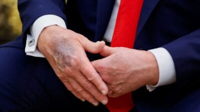 I nternet dedikodularla calkalaniyordu trump sonunda konustu sagligi hakkinda sunlari soyledi 8756