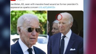 Joe biden in kafasinda buyuk bir yara var ne oldugu biliniyor ciddi bir hastalik 9206