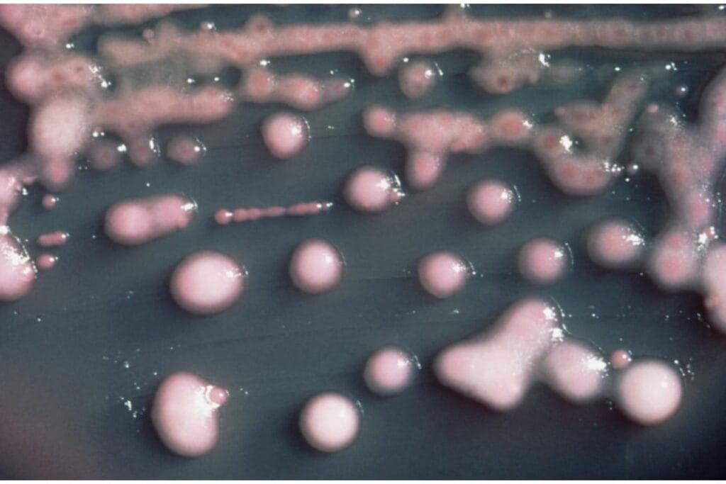 kabus bocegi abd de hizla yayiliyor yuzde 460 artis ciddi bir tehdit 13117