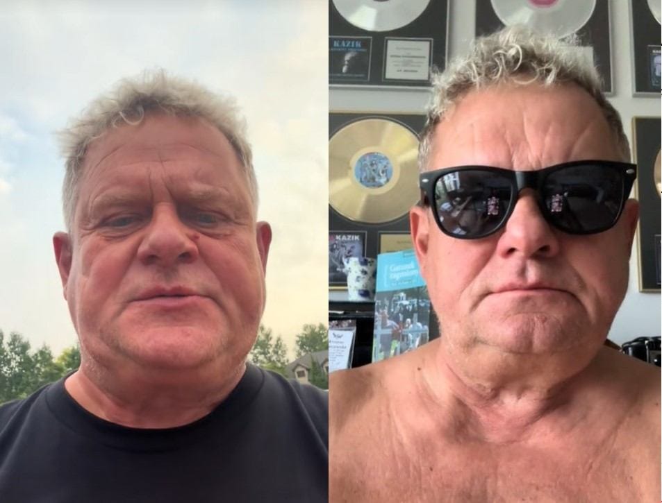 kazik in skandal sarkisi biedro u asacaksin seni k o je a 9605