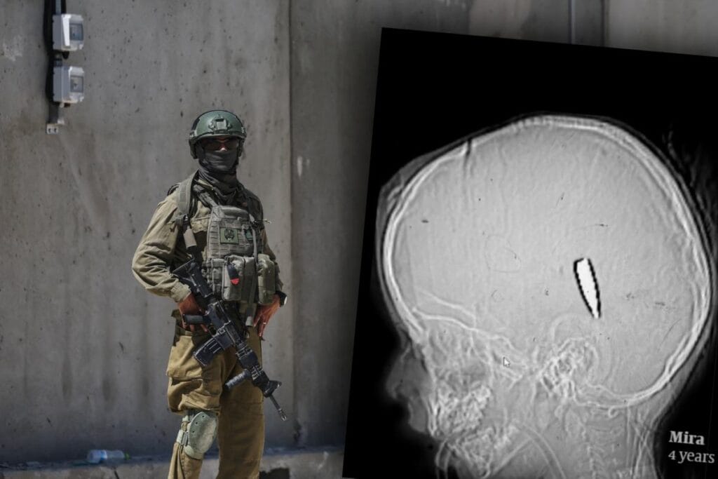 yuzden fazla filistinli cocuk basindan ve govdesinden vuruldu uzmanlar bu kasitli bir eylemi gosteriyor 11370