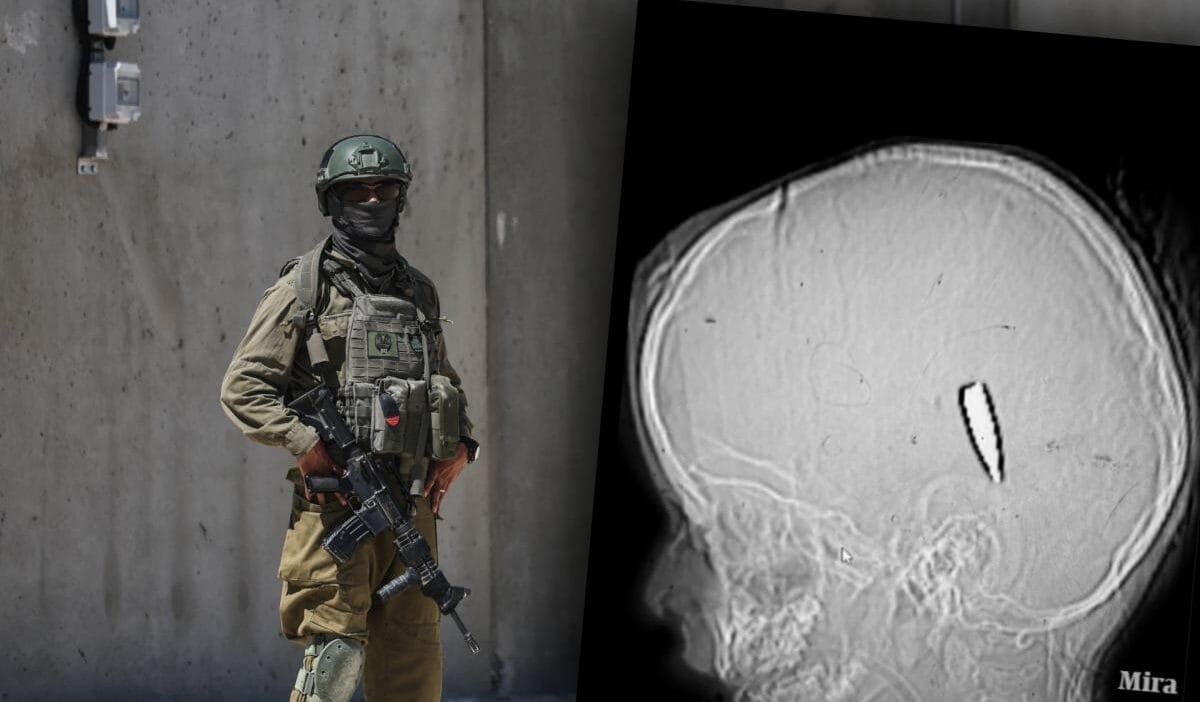 Yuzden fazla filistinli cocuk basindan ve govdesinden vuruldu uzmanlar bu kasitli bir eylemi gosteriyor 11370