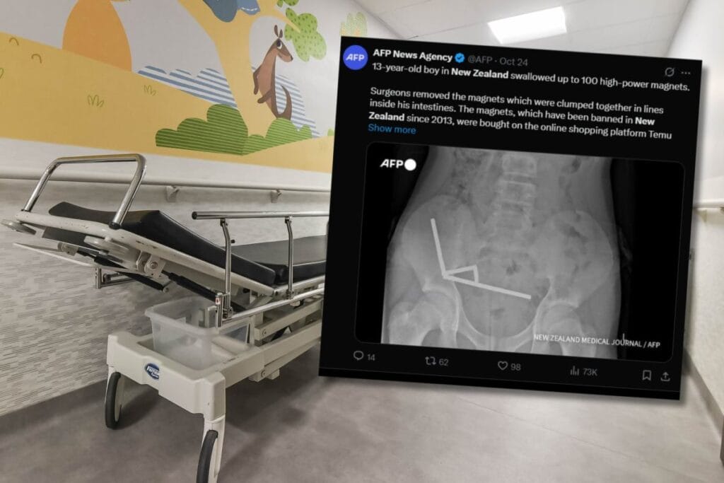 doktorlar 13 yasindaki cocugun fotografini gorduklerinde sok oldular miknatislar bagirsaklarda kaynasmaya basladi 19197