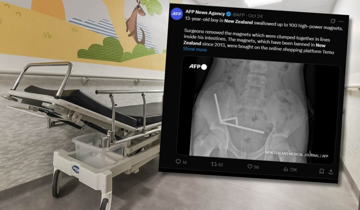 Doktorlar 13 yasindaki cocugun fotografini gorduklerinde sok oldular miknatislar bagirsaklarda kaynasmaya basladi 19197