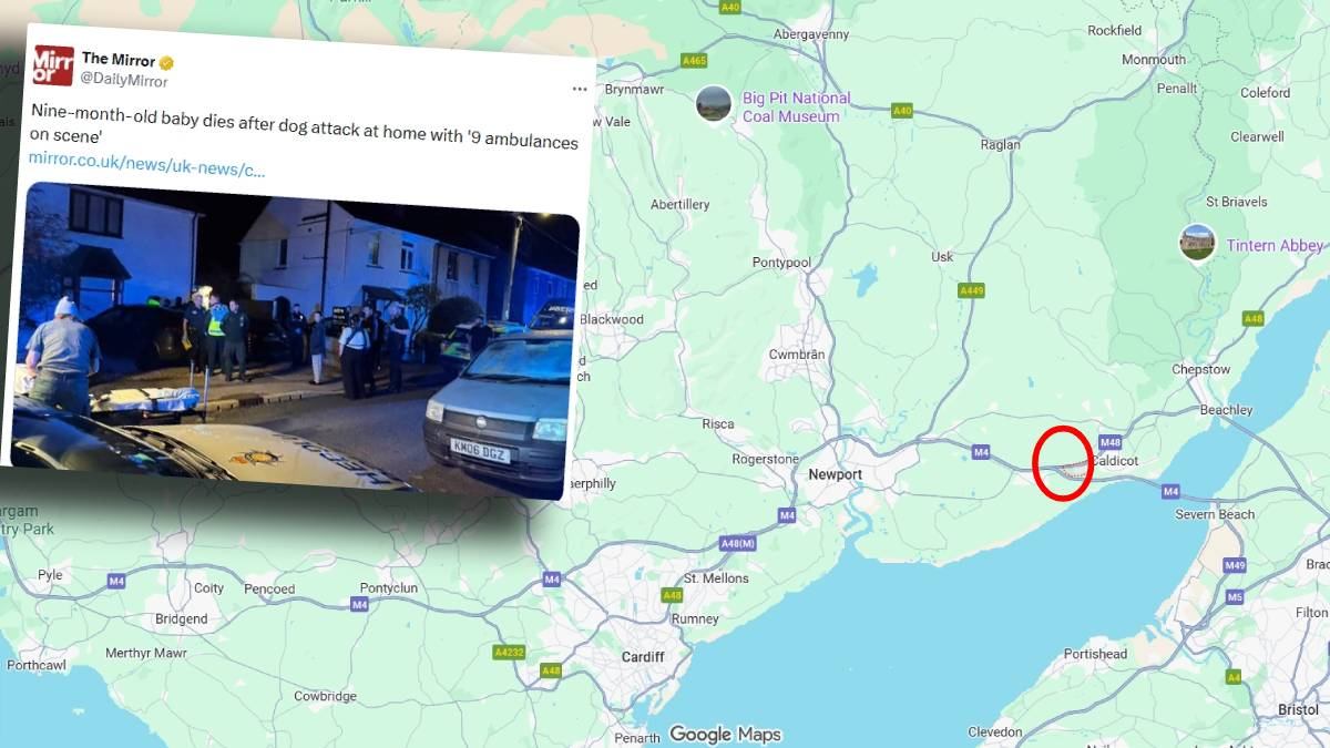 9 aylik bebek kopek tarafindan saldiriya ugradi polis olayla ilgili sorusturmayi surduruyor 20828