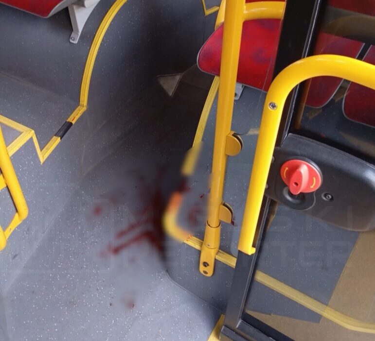 Kopek belediye otobusundeki kadin yolcuyu isirdi sahibi para cezasina carptirildi 23151