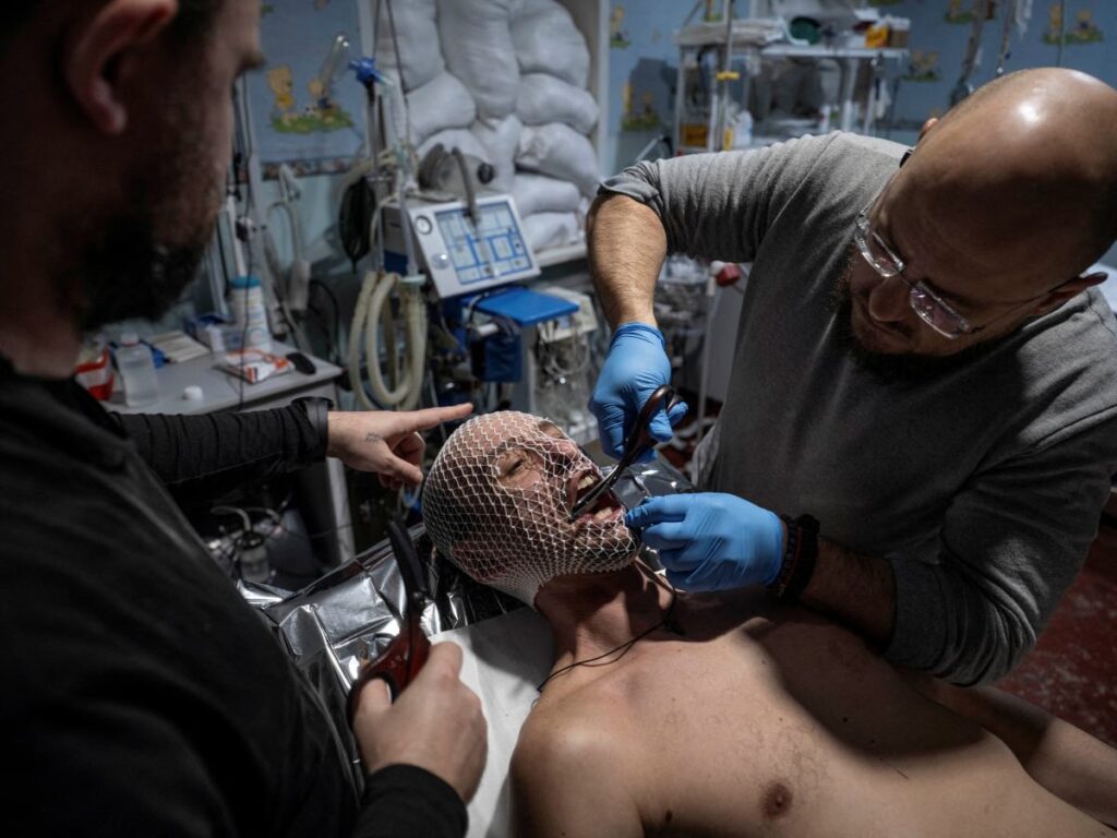 ukrayna da tehlikeli bir hastalik birinci dunya savasi zamanindan kalma bir fenomen 22707