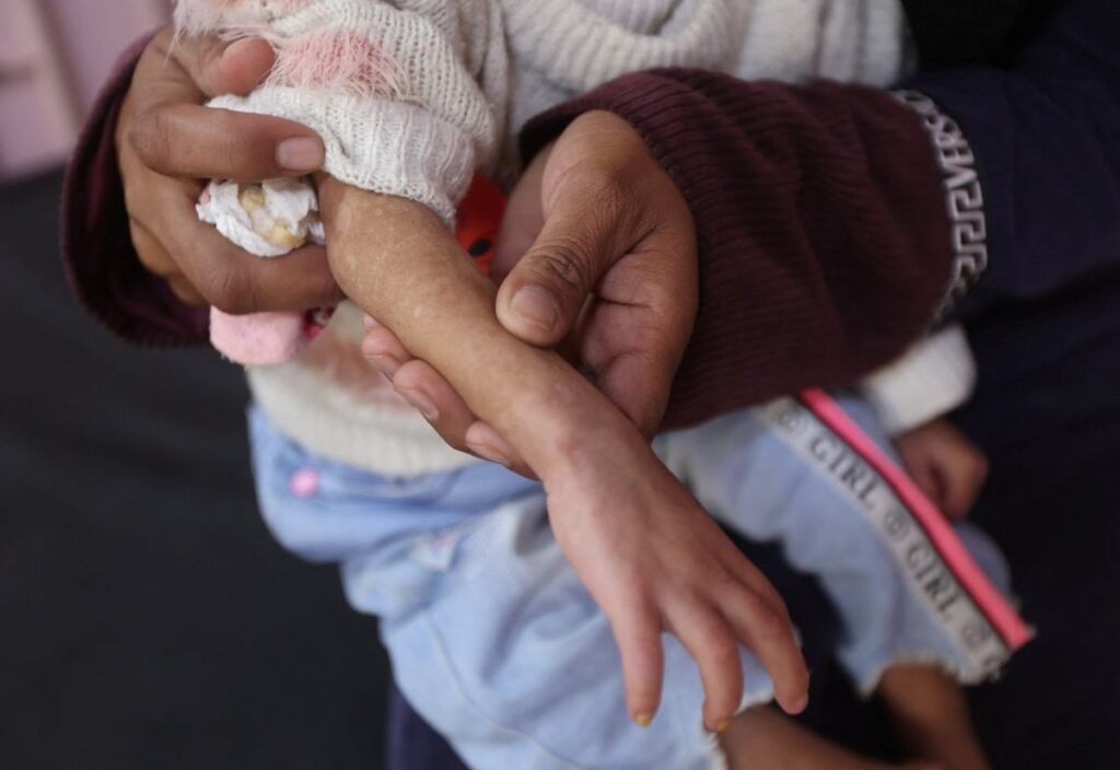 gazze de cocuklar soguktan oluyor hayatta kalmak icin temel ihtiyaclarin eksikligi var 31383