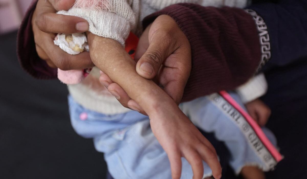 Gazze de cocuklar soguktan oluyor hayatta kalmak icin temel ihtiyaclarin eksikligi var 31383