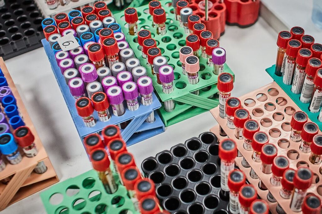 romanya da cuzzam kirk yili askin bir suredir ilk kez yetkililer romanya da 29748