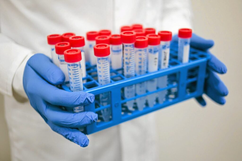 sperminden yaklasik 200 cocuk hamile kaldi onlara tehlikeli bir mutasyon gecirdi 28882