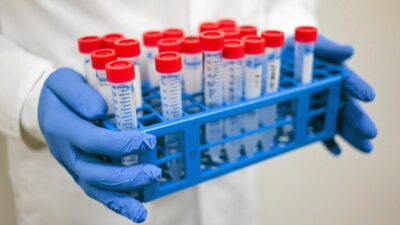 Sperminden yaklasik 200 cocuk hamile kaldi onlara tehlikeli bir mutasyon gecirdi 28882