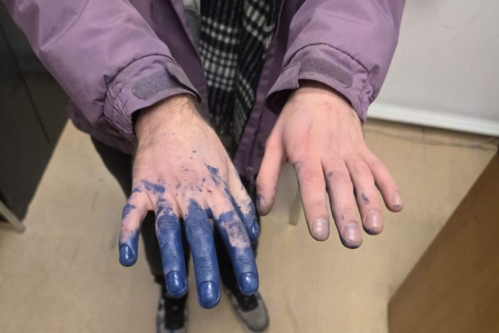 G ra kalwari de yakalanan genc grafigini dunya durumuna dair gorusleriyle savunacak 40166