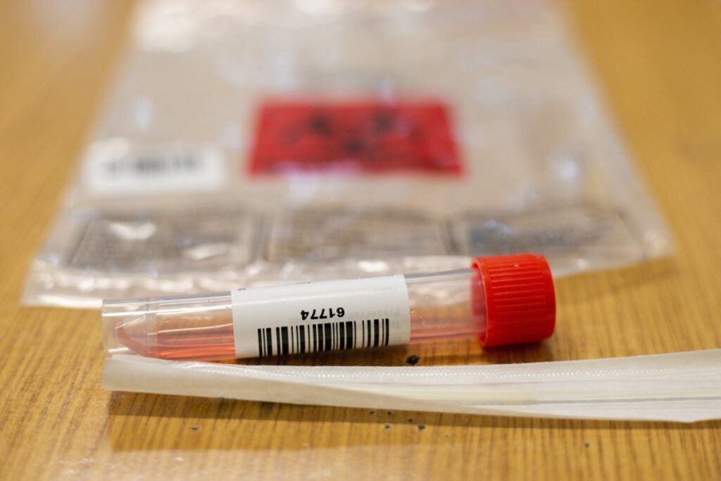 nipah virusu asya da yeni vaka ve karantina tedbirleriyle gundemde 39146