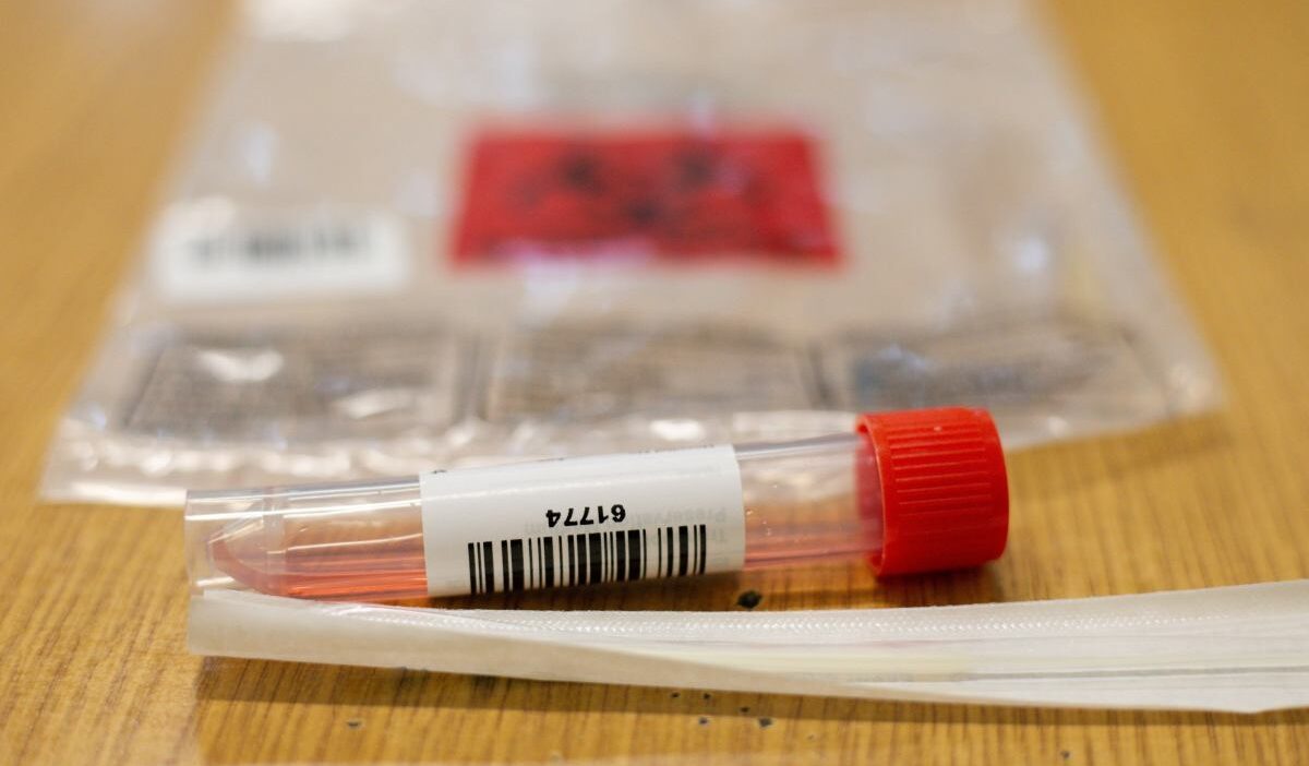 Nipah virusu asya da yeni vaka ve karantina tedbirleriyle gundemde 39146