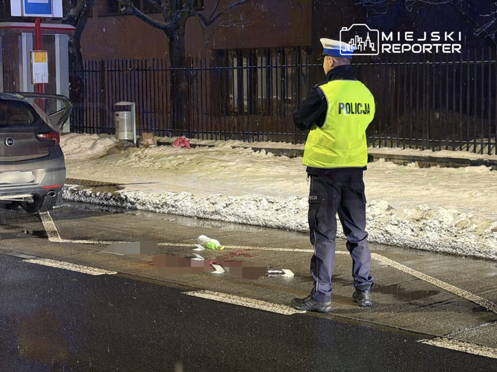 piaseczny i lcesi nde machete ile otobus duragi saldirisi supheli gozaltina alindi kurban hastanede 40412