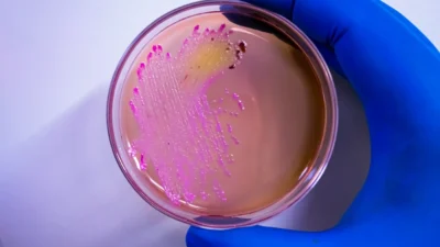 Brezilya da arastirmacidan tehlikeli virus hirsizligi 56609