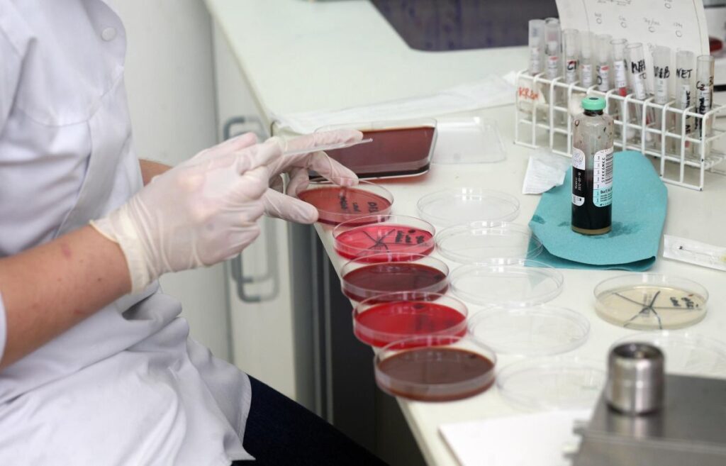 brezilya da yuksek guvenlikli laboratuvardan virus ornekleri kayboldu zanli gozaltina alindi 56718