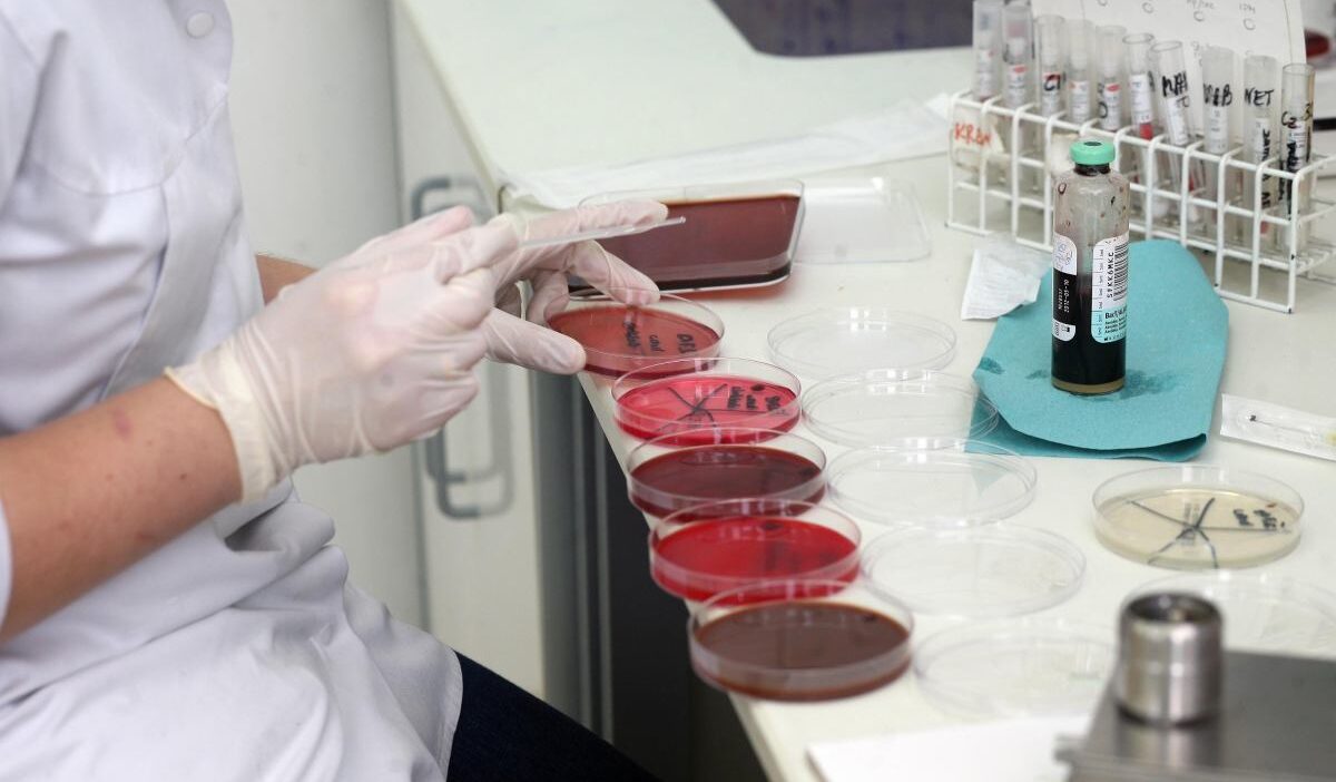 Brezilya'da yüksek güvenlikli laboratuvardan virüs örnekleri kayboldu, zanlı gözaltına alındı 1 Brezilya da yuksek guvenlikli laboratuvardan virus ornekleri kayboldu zanli gozaltina alindi 56718