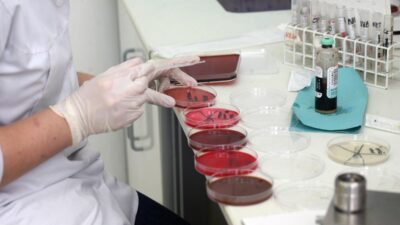 Brezilya da yuksek guvenlikli laboratuvardan virus ornekleri kayboldu zanli gozaltina alindi 56718