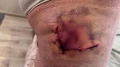 Polonya'da yaban domuzu saldırısı: 78 yaşındaki kadın hastanelik oldu 2 Polonya da yaban domuzu saldirisi 78 yasindaki kadin hastanelik oldu 56647