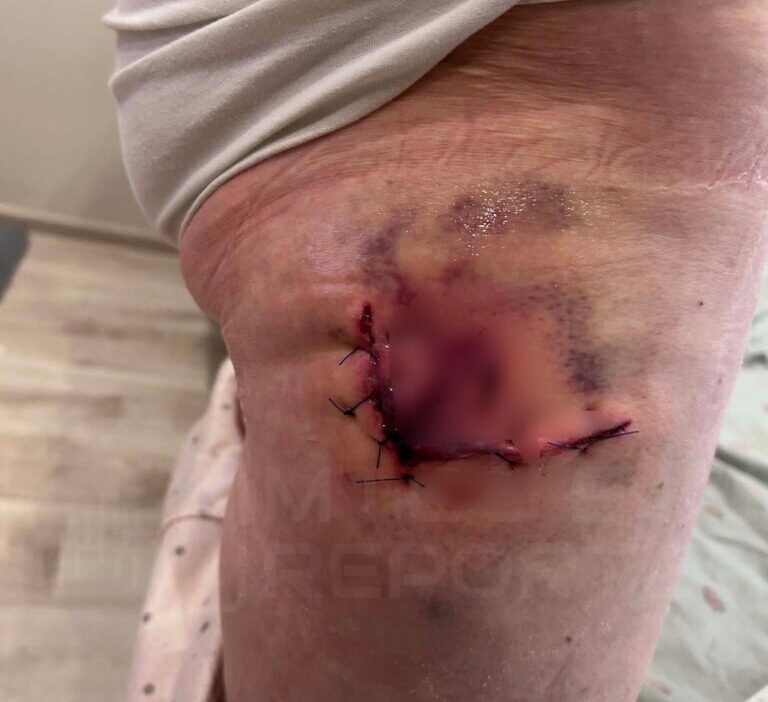 Polonya da yaban domuzu saldirisi 78 yasindaki kadin hastanelik oldu 56647