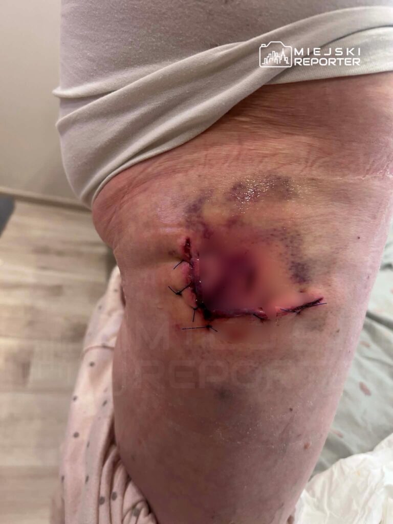 polonya da yaban domuzu saldirisi 78 yasindaki kadin hastanelik oldu 56647