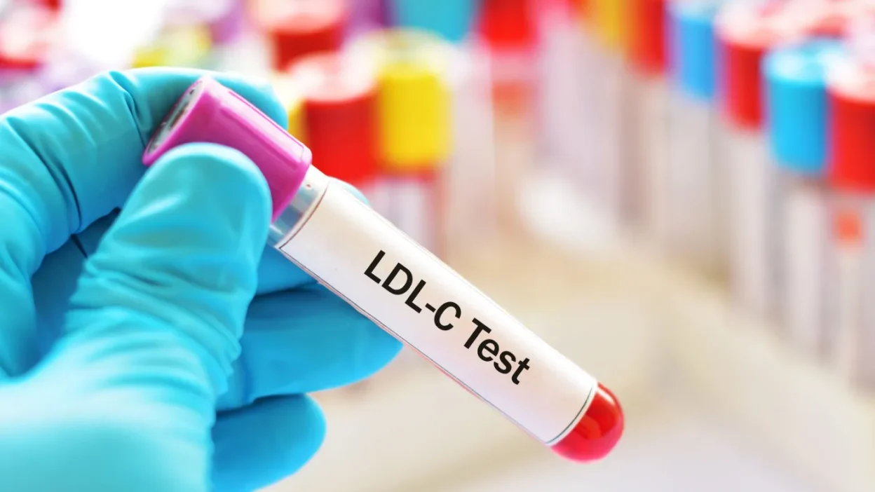 2026 da kolesterol normlari degisiyor 100 mg dl artik yuksek mu 60919