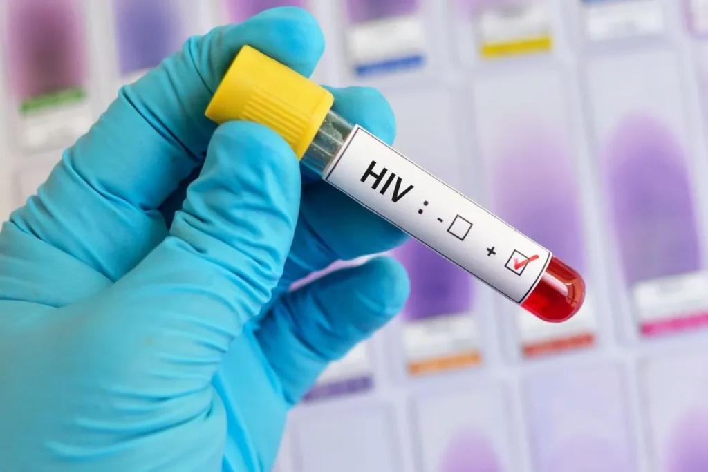 polonya da hcv ve hiv tedavisi kamu fonlarindan karsilanacak 61875