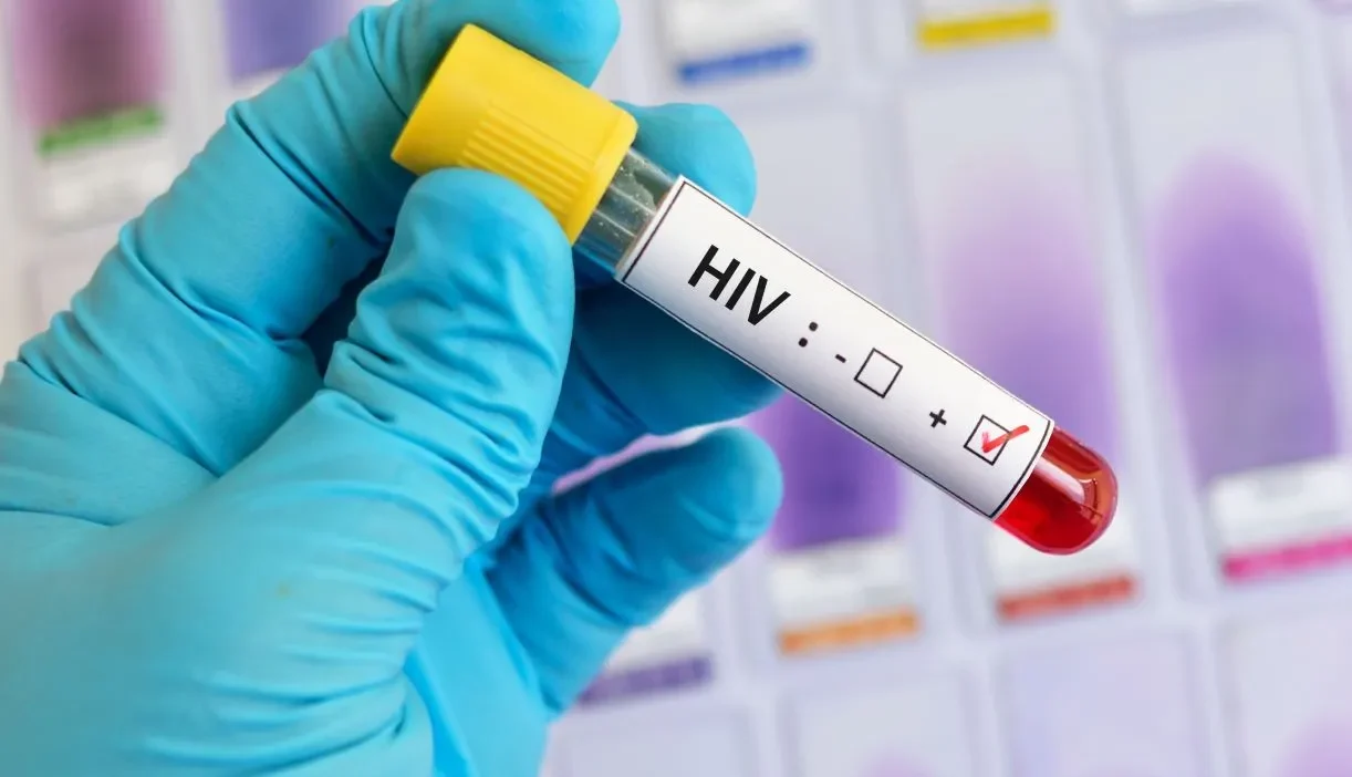 Polonya da hcv ve hiv tedavisi kamu fonlarindan karsilanacak 61875