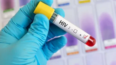Polonya'da hcv ve hiv tedavisi kamu fonlarından karşılanacak 4 Polonya da hcv ve hiv tedavisi kamu fonlarindan karsilanacak 61875