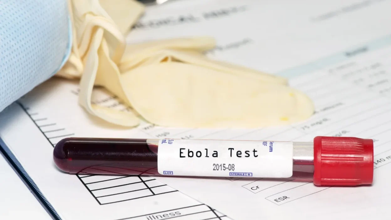 Polonya saglik mufettisligi nden ebola ve hantavirus aciklamasi 72857